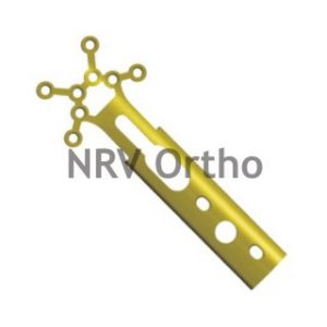 DYNAMIC TROCHANTER STABILIZER PLATE